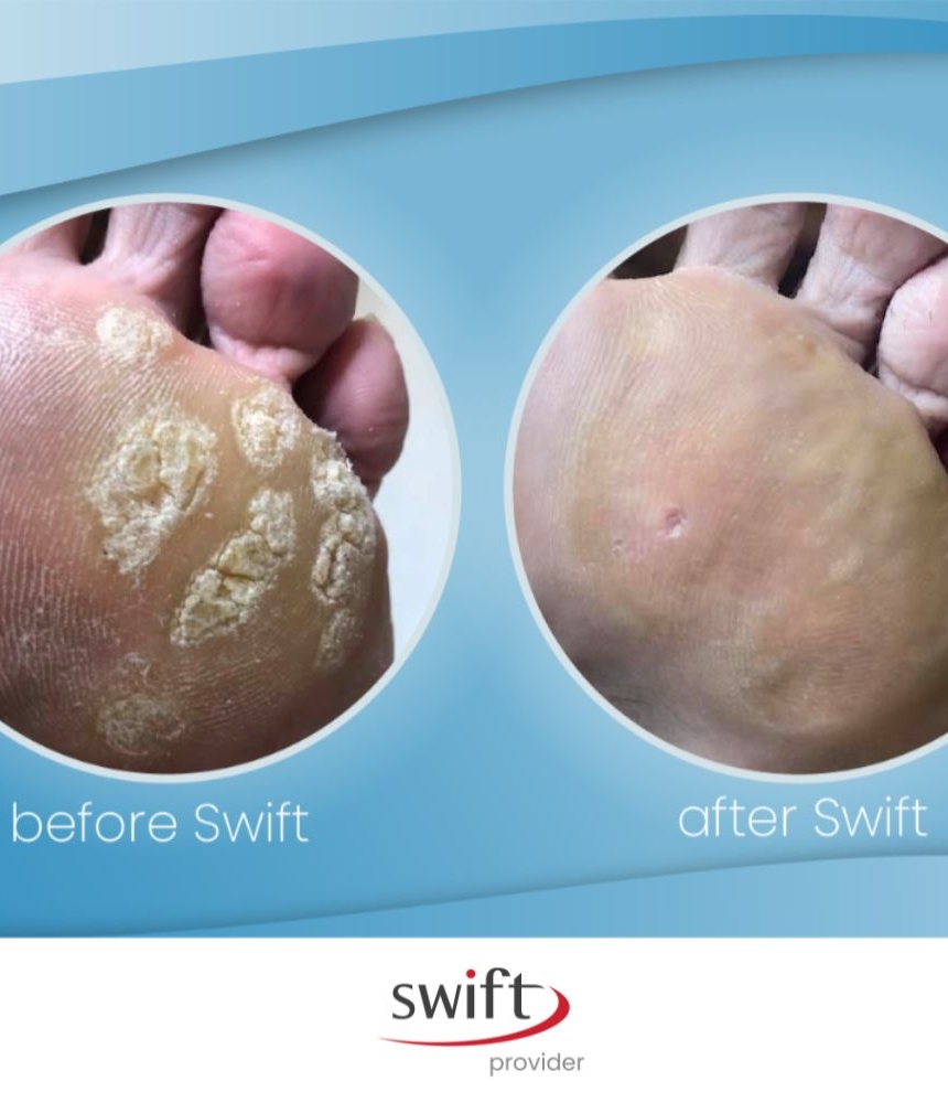 Swift 19 swift provider